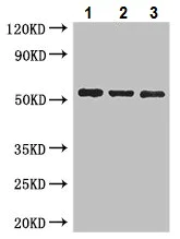 Western blot - Anti-SH3BP5 antibody (AB222860)