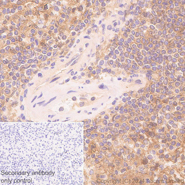 Immunohistochemistry (Formalin/PFA-fixed paraffin-embedded sections) - Anti-SH3GL1/Endophilin A2 antibody [EPR29123-74] (AB321807)