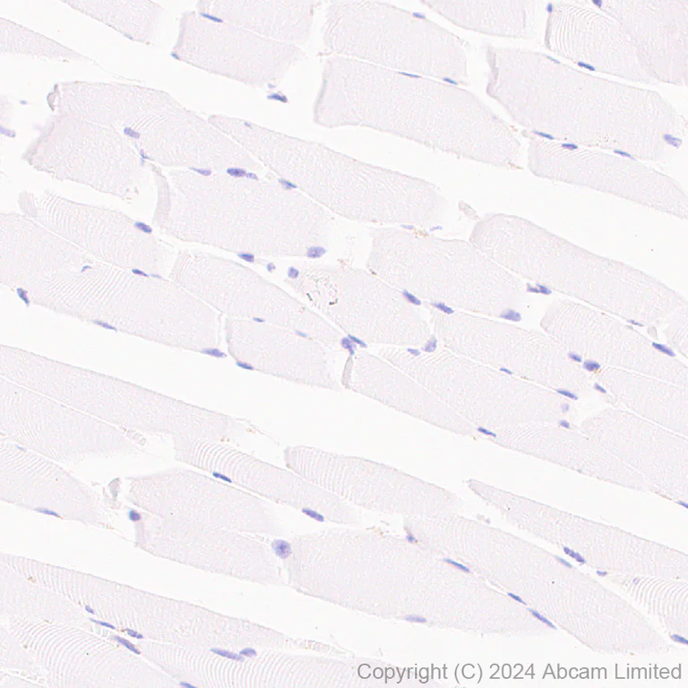 Immunohistochemistry (Formalin/PFA-fixed paraffin-embedded sections) - Anti-SH3GL1/Endophilin A2 antibody [EPR29123-74] (AB321807)