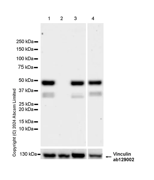 Western blot - Anti-SH3GL1/Endophilin A2 antibody [EPR29123-74] (AB321807)