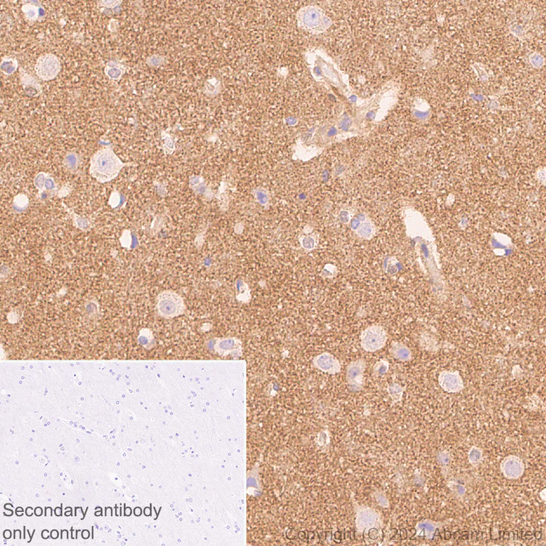 Immunohistochemistry (Formalin/PFA-fixed paraffin-embedded sections) - Anti-SH3GL1/Endophilin A2 antibody [EPR29123-74] - BSA and Azide free (AB321808)