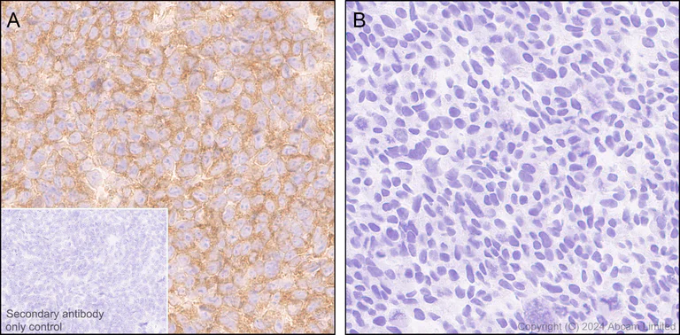 Immunohistochemistry (Formalin/PFA-fixed paraffin-embedded sections) - Anti-SH3GL1/Endophilin A2 antibody [EPR29123-74] - BSA and Azide free (AB321808)
