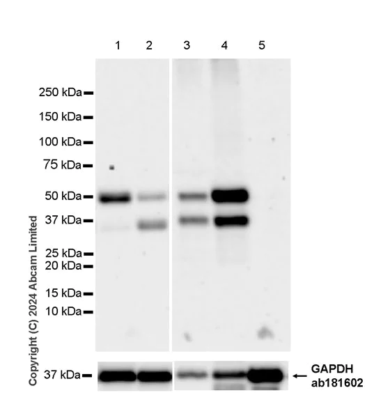Western blot - Anti-SH3GL1/Endophilin A2 antibody [EPR29123-74] - BSA and Azide free (AB321808)