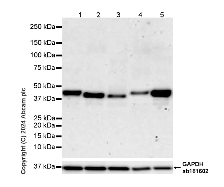Western blot - Anti-SH3GL1/Endophilin A2 antibody [K51/1] - BSA and Azide free (AB317836)