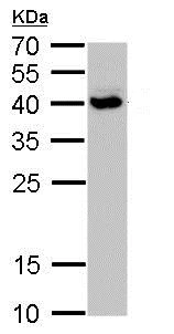 Western blot - Anti-SH3GL3 antibody (AB184008)