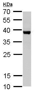 Western blot - Anti-SH3GL3 antibody (AB184008)