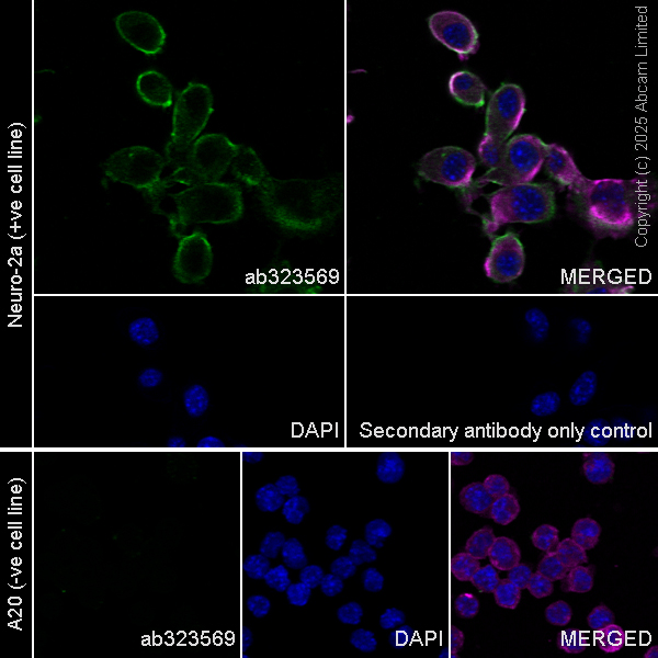 Immunocytochemistry/ Immunofluorescence - Anti-SH3GL3 antibody [EPR29565-553] (AB323569), expandable thumbnail