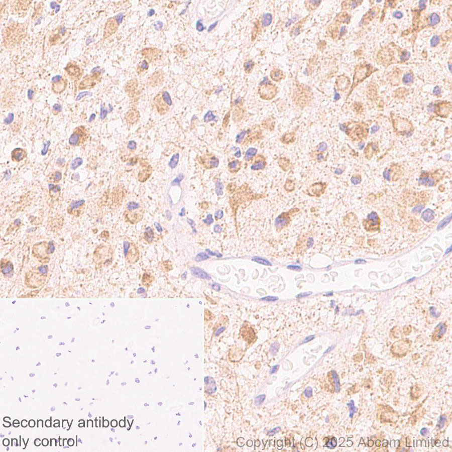 Immunohistochemistry (Formalin/PFA-fixed paraffin-embedded sections) - Anti-SH3GL3 antibody [EPR29565-553] (ab323569), expandable thumbnail
