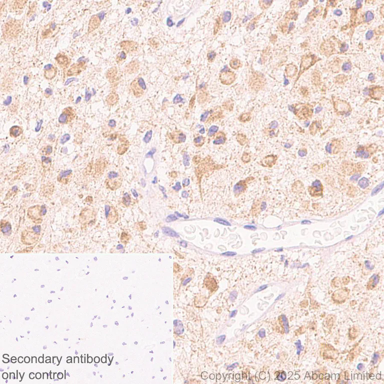 Immunohistochemistry (Formalin/PFA-fixed paraffin-embedded sections) - Anti-SH3GL3 antibody [EPR29565-553] (AB323569)