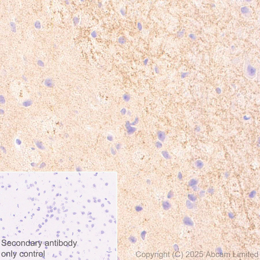 Immunohistochemistry (Formalin/PFA-fixed paraffin-embedded sections) - Anti-SH3GL3 antibody [EPR29565-553] (ab323569), expandable thumbnail