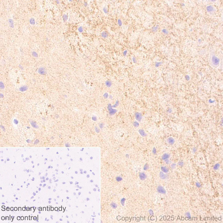 Immunohistochemistry (Formalin/PFA-fixed paraffin-embedded sections) - Anti-SH3GL3 antibody [EPR29565-553] (AB323569)