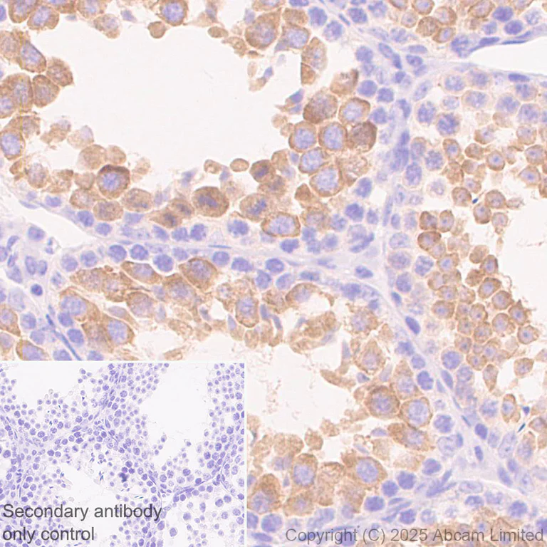 Immunohistochemistry (Formalin/PFA-fixed paraffin-embedded sections) - Anti-SH3GL3 antibody [EPR29565-553] (AB323569)