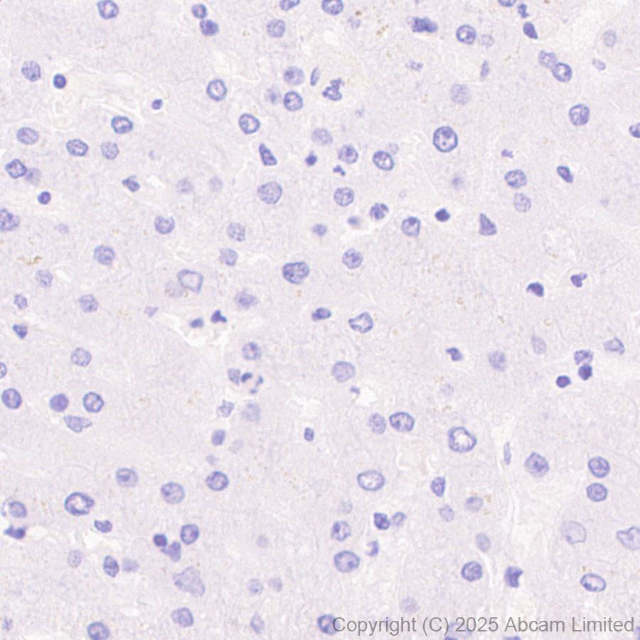 Immunohistochemistry (Formalin/PFA-fixed paraffin-embedded sections) - Anti-SH3GL3 antibody [EPR29565-553] (ab323569), expandable thumbnail