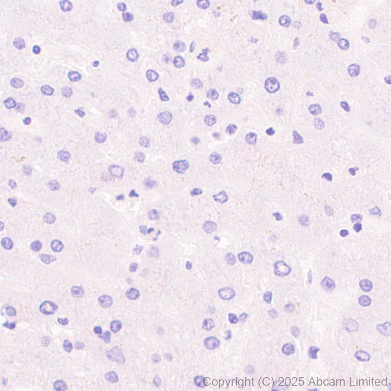 Immunohistochemistry (Formalin/PFA-fixed paraffin-embedded sections) - Anti-SH3GL3 antibody [EPR29565-553] (AB323569)