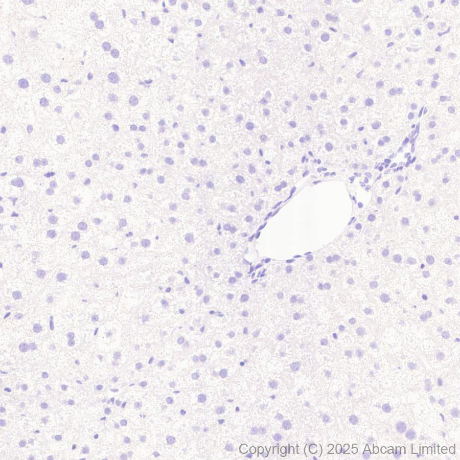 Immunohistochemistry (Formalin/PFA-fixed paraffin-embedded sections) - Anti-SH3GL3 antibody [EPR29565-553] (ab323569), expandable thumbnail