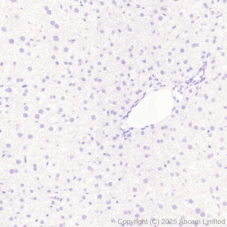 Immunohistochemistry (Formalin/PFA-fixed paraffin-embedded sections) - Anti-SH3GL3 antibody [EPR29565-553] (AB323569)