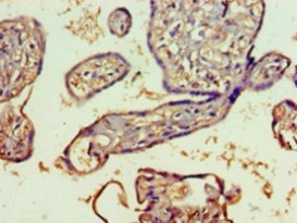 Immunohistochemistry (Formalin/PFA-fixed paraffin-embedded sections) - Anti-SH3GLB2 antibody (AB235352)