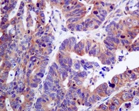 Immunohistochemistry (Formalin/PFA-fixed paraffin-embedded sections) - Anti-SH3KBP1 antibody [EPR7881(2)] (AB151574)