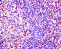 Immunohistochemistry (Formalin/PFA-fixed paraffin-embedded sections) - Anti-SH3KBP1 antibody [EPR7881(2)] (AB151574)