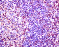 Immunohistochemistry (Formalin/PFA-fixed paraffin-embedded sections) - Anti-SH3KBP1 antibody [EPR7881(2)] (AB151574)