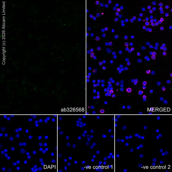 Immunocytochemistry/ Immunofluorescence - Anti-SH3MD2 antibody [EPR30521-594] (AB326568)