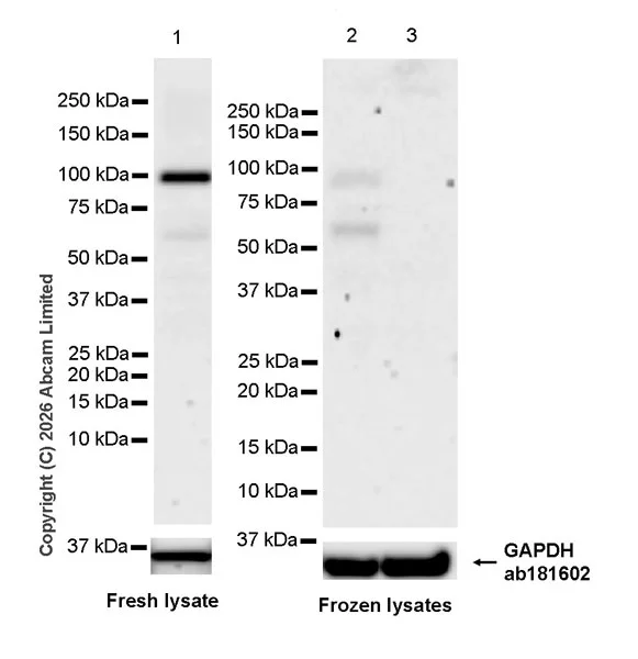 Western blot - Anti-SH3MD2 antibody [EPR30521-594] (AB326568)