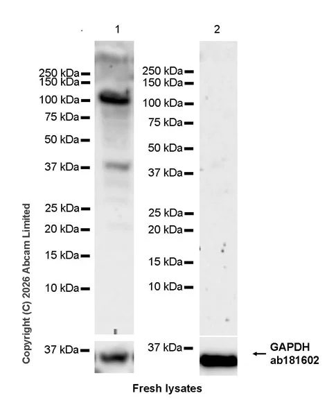 Western blot - Anti-SH3MD2 antibody [EPR30521-594] (AB326568)