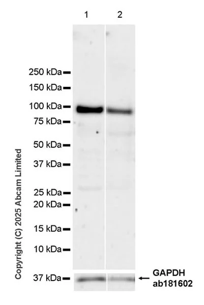 Western blot - Anti-SH3MD2 antibody [EPR30521-594] (AB326568)