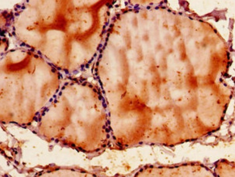 Immunohistochemistry (Formalin/PFA-fixed paraffin-embedded sections) - Anti-SH3PX1/SNX9 antibody (AB222911)