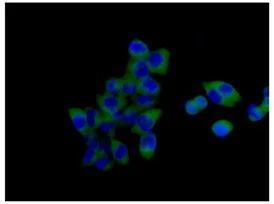 Immunocytochemistry/ Immunofluorescence - Anti-SH3PX1/SNX9 antibody [EPR14399] (AB181856)