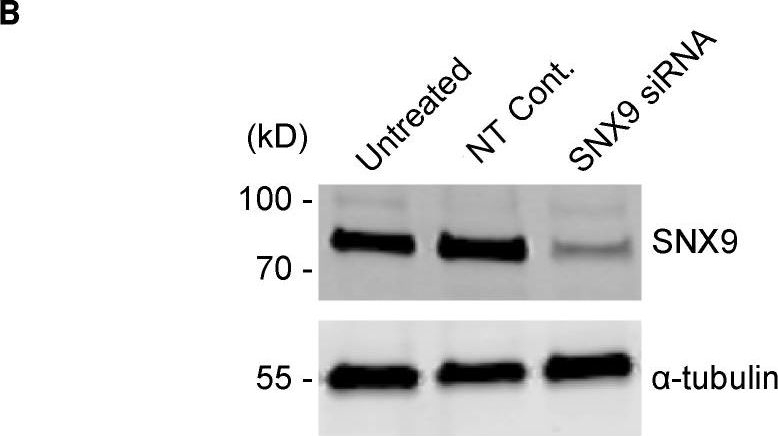 Western blot - Anti-SH3PX1/SNX9 antibody [EPR14399] (ab181856), expandable thumbnail