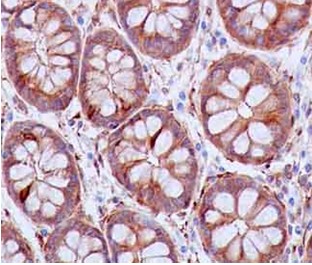 Immunohistochemistry (Formalin/PFA-fixed paraffin-embedded sections) - Anti-SH3PX1/SNX9 antibody [EPR14399] - BSA and Azide free (ab250527), expandable thumbnail