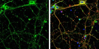 Immunocytochemistry/ Immunofluorescence - Anti-SHANK1 antibody (AB154224)