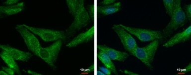 Immunocytochemistry/ Immunofluorescence - Anti-SHANK1 antibody (AB154224)