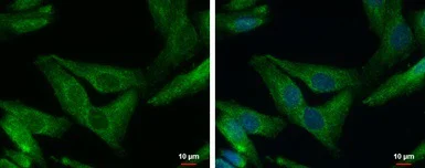 Immunocytochemistry/ Immunofluorescence - Anti-SHANK1 antibody (AB154224)