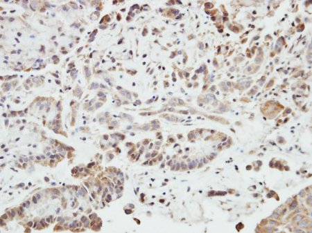 Immunohistochemistry (Formalin/PFA-fixed paraffin-embedded sections) - Anti-SHANK1 antibody (AB154224), expandable thumbnail