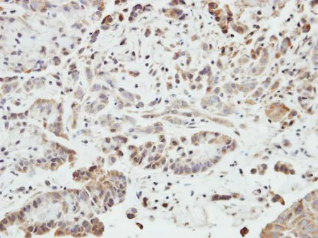 Immunohistochemistry (Formalin/PFA-fixed paraffin-embedded sections) - Anti-SHANK1 antibody (AB154224)