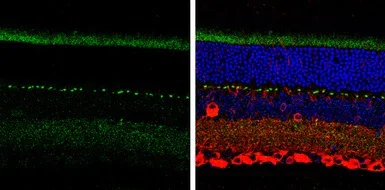 Immunohistochemistry (Formalin/PFA-fixed paraffin-embedded sections) - Anti-SHANK1 antibody (AB154224)