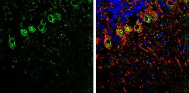 Immunohistochemistry (Frozen sections) - Anti-SHANK1 antibody (AB154224)