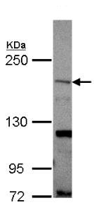 Western blot - Anti-SHANK1 antibody (AB154224), expandable thumbnail