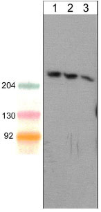 Western blot - Anti-SHANK1 antibody [M369] (AB157766)