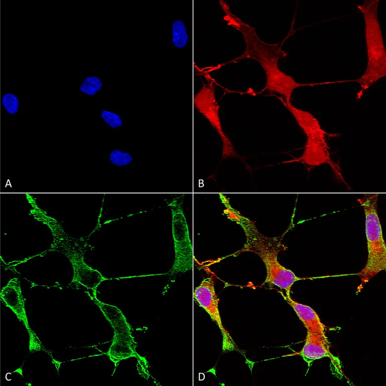 Immunocytochemistry/ Immunofluorescence - Anti-SHANK1 antibody [N22/21] (AB94576)