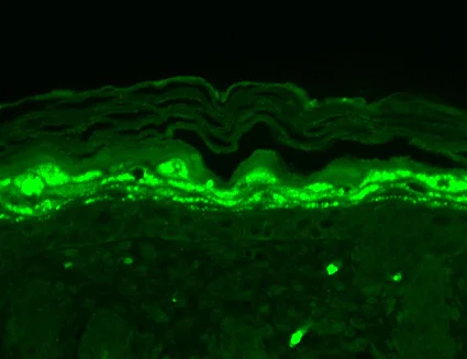 Immunohistochemistry paraffin embedded sections - Anti-SHANK1 antibody [N22/21] (AB94576)