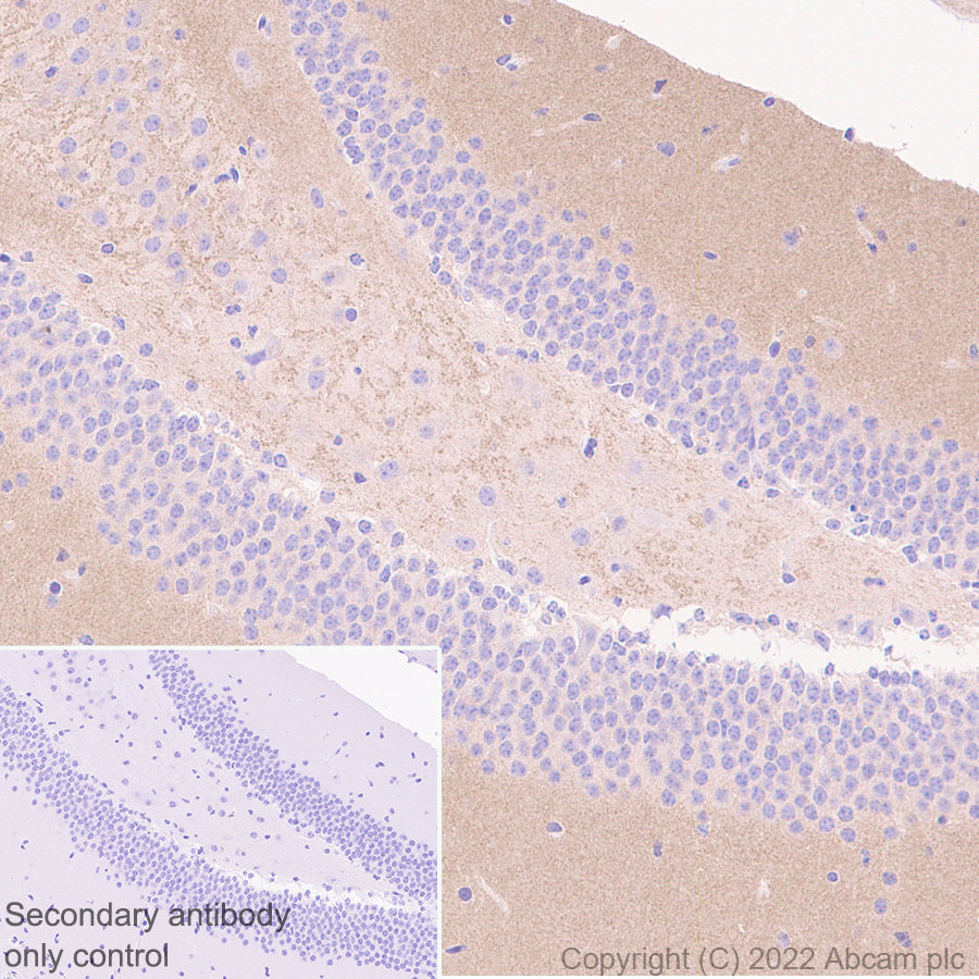 Immunohistochemistry (Formalin/PFA-fixed paraffin-embedded sections) - Anti-SHANK1 + SHANK2 + SHANK3 antibody [EPR26549-87] (ab317608), expandable thumbnail