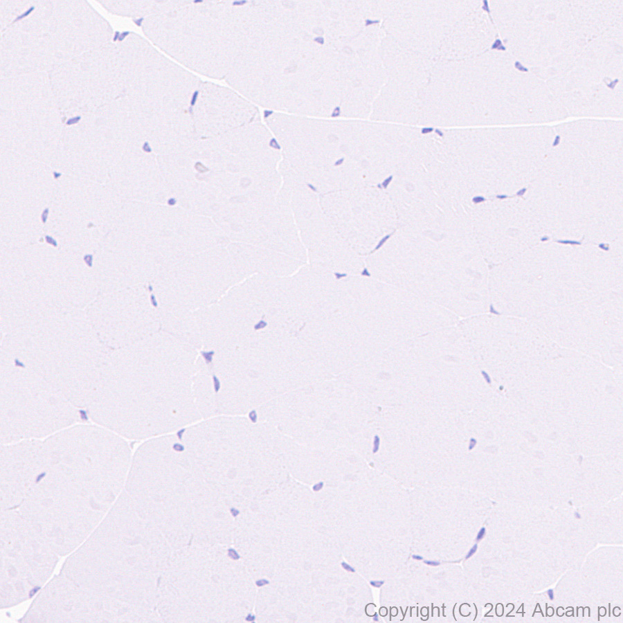 Immunohistochemistry (Formalin/PFA-fixed paraffin-embedded sections) - Anti-SHANK1 + SHANK2 + SHANK3 antibody [EPR26549-87] (ab317608), expandable thumbnail