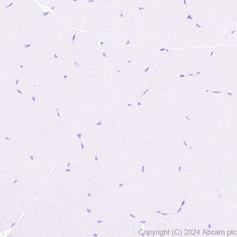 Immunohistochemistry (Formalin/PFA-fixed paraffin-embedded sections) - Anti-SHANK1 + SHANK2 + SHANK3 antibody [EPR26549-87] (AB317608)