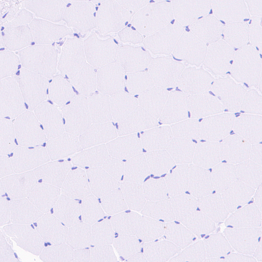 Immunohistochemistry (Formalin/PFA-fixed paraffin-embedded sections) - Anti-SHANK1 + SHANK2 + SHANK3 antibody [EPR26549-87] (ab317608), expandable thumbnail