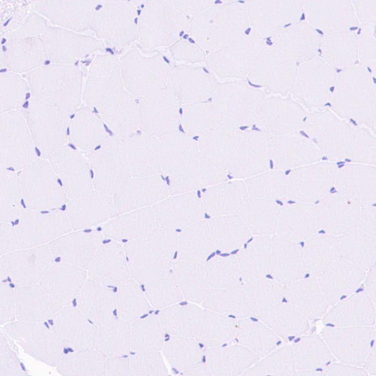 Immunohistochemistry (Formalin/PFA-fixed paraffin-embedded sections) - Anti-SHANK1 + SHANK2 + SHANK3 antibody [EPR26549-87] - BSA and Azide free (AB317609)