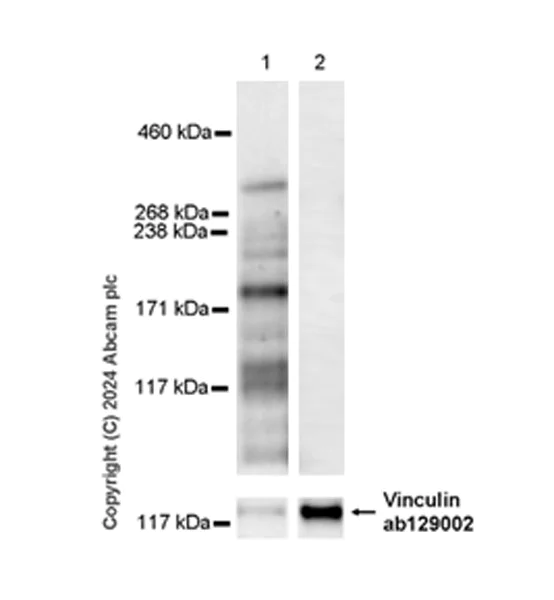 Western blot - Anti-SHANK1 + SHANK2 + SHANK3 antibody [EPR26549-87] - BSA and Azide free (AB317609)