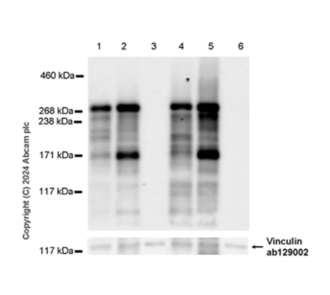 Western blot - Anti-SHANK1 + SHANK2 + SHANK3 antibody [EPR26549-87] - BSA and Azide free (AB317609)